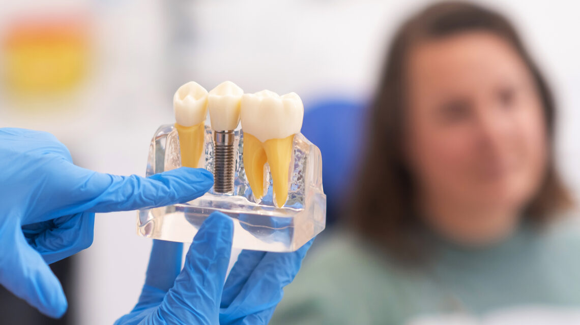 مرحلة التحضير